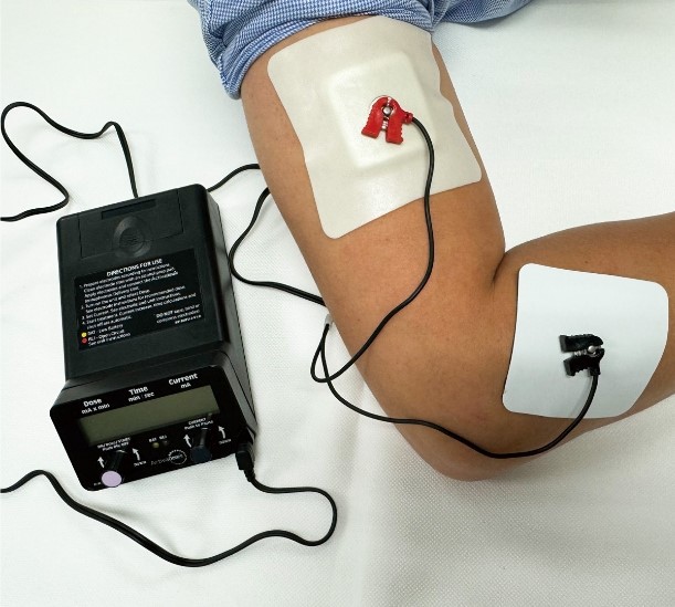 Iontophoresis Iontophoresis